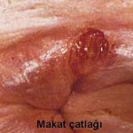 makat-catlagi